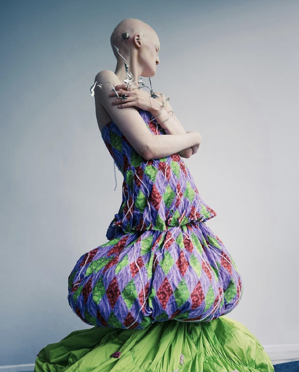 Disabled model defies bullies by walking London Fashion Week ...
